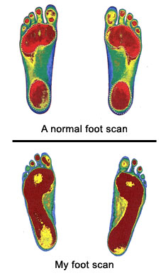 foot-scan-r